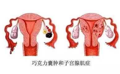 通草的功效與作用，探索其在輸卵管堵塞治療中的應(yīng)用