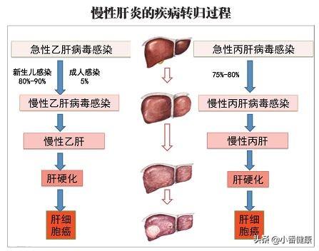 大三陽最新治療方法，探索與希望
